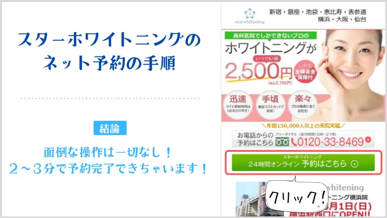 スターホワイトニングのネット予約の手順
